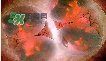 多胞胎是怎么生產(chǎn)的？多胞胎應(yīng)選擇什么分娩方式
