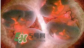 多胞胎順產(chǎn)怎么生？多胞胎剖腹產(chǎn)和單胎剖腹產(chǎn)的區(qū)別
