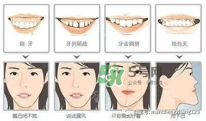 乳牙齲齒要不要補(bǔ)？乳牙齲齒怎么辦？