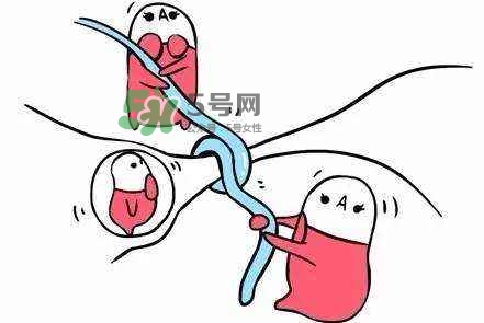 結(jié)扎好還是上環(huán)好？結(jié)扎上環(huán)哪個(gè)危害小？