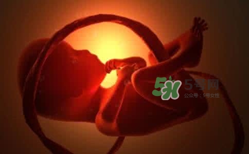 寶寶臍帶繞頸只能剖腹產(chǎn)嗎？胎兒臍帶繞頸孕婦有什么感覺(jué)