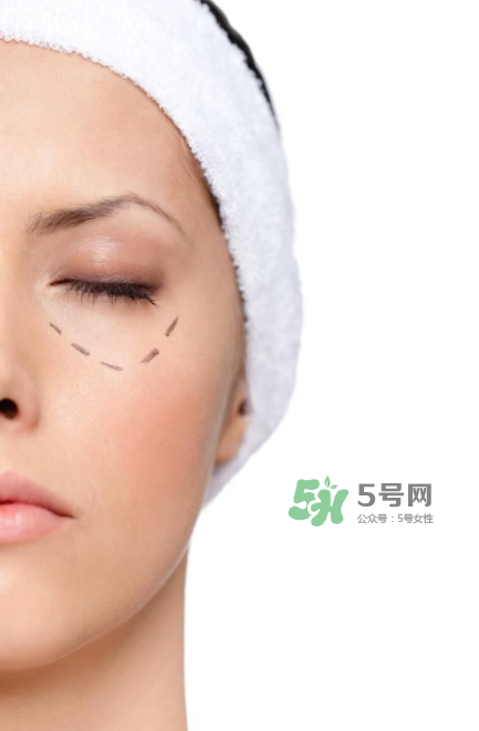 近視手術(shù)多少度不能做？多少度可以做近視手術(shù)？