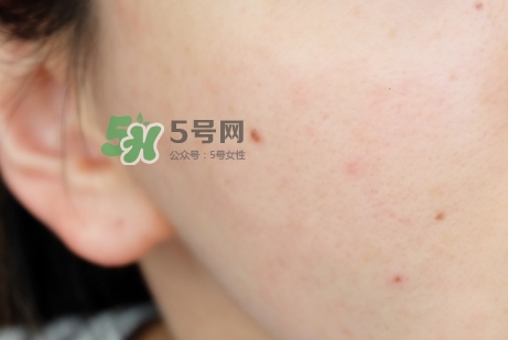 臘梅是什么牌子？臘梅是什么護膚品
