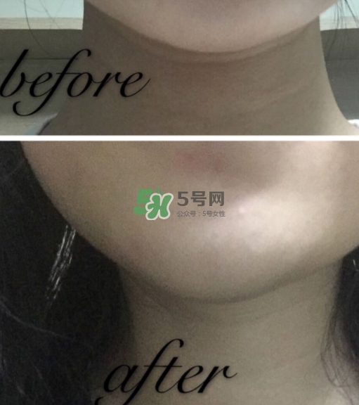 olay小白瓶有哪些版本？olay小白瓶版本區(qū)別