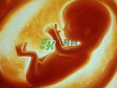 臍帶繞頸是什么原因造成的？臍帶繞頸是多休息還是多運動？