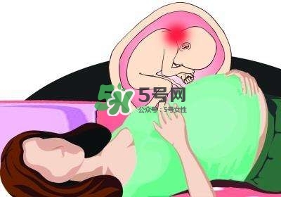 孕婦左側臥睡不著怎么辦？孕期左側睡不舒服怎么辦？