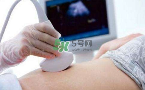 臍帶繞頸是什么原因造成的？臍帶繞頸是多休息還是多運動？