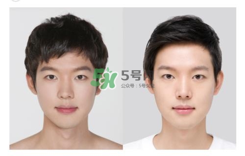 美白針有副作用嗎？美白針有什么副作用？