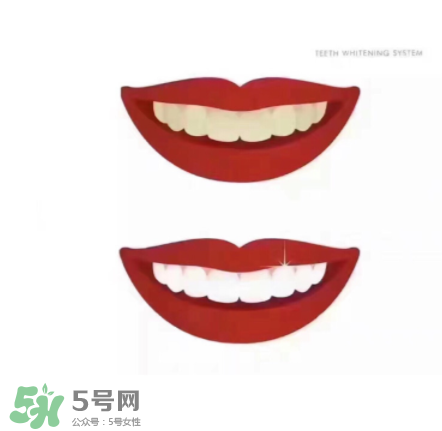 美牙儀能帶上飛機(jī)嗎？美牙儀可以過安檢嗎？