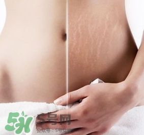 妊娠紋什么時(shí)候變白？妊娠紋產(chǎn)品什么時(shí)候用？