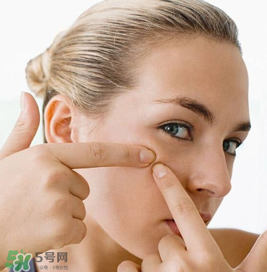 長(zhǎng)痘長(zhǎng)閉口怎么辦？長(zhǎng)痘長(zhǎng)閉口是什么原因？