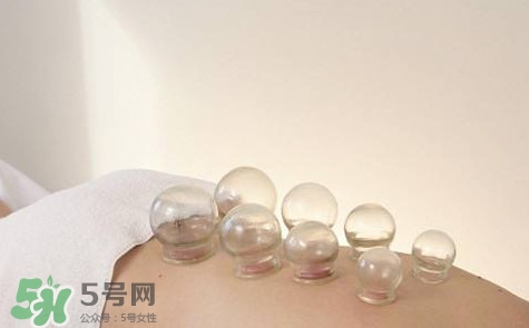 真空拔罐有用嗎？真空拔罐多長時間合適