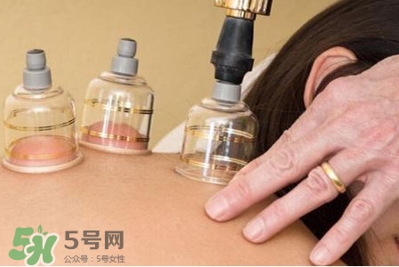 真空拔罐有用嗎？真空拔罐多長時間合適