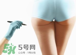 吸脂減肥副作用有哪些？吸脂減肥可靠嗎？