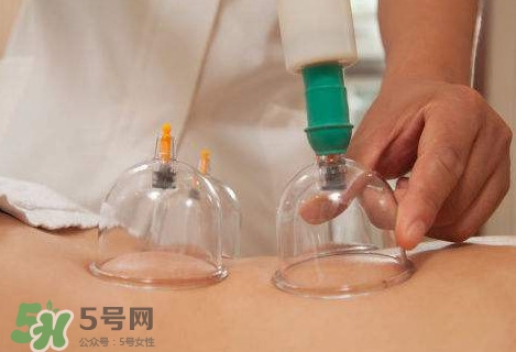 真空拔罐有用嗎？真空拔罐多長時間合適