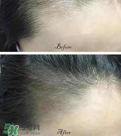 發(fā)際線粉要卸妝嗎_怎么卸？