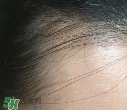 發(fā)際線粉要卸妝嗎_怎么卸？