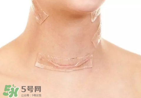硅膠疤痕貼有用嗎？硅膠疤痕貼效果怎么樣？