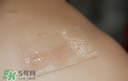 仙卡疤痕貼有用嗎？仙卡疤痕貼效果怎么樣？