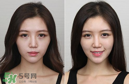 蘋果肌怎么化？蘋果肌究竟哪里好？
