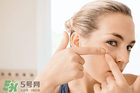 暗瘡可以擠壓嗎？油性和骯臟肌膚會容易有暗瘡嗎？