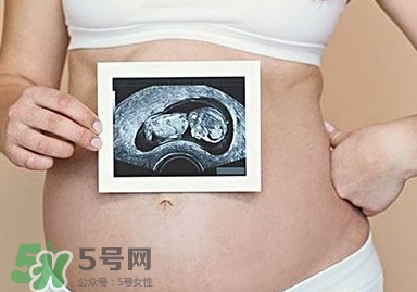 雙子宮可以上環(huán)嗎？雙子宮上環(huán)要注意哪些？
