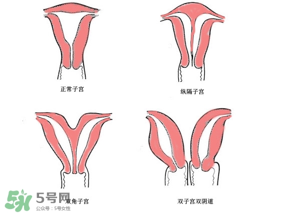 雙子宮是什么意思？雙子宮可以順產(chǎn)嗎？