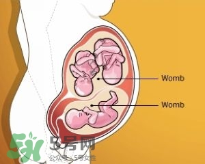 雙子宮是什么意思？雙子宮可以順產(chǎn)嗎？