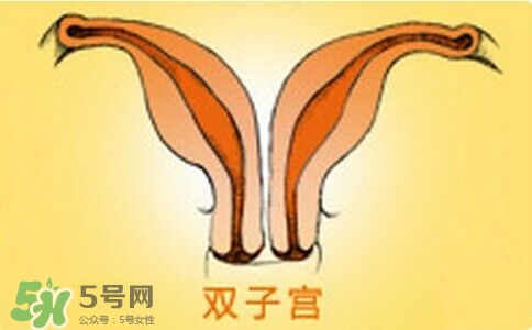 雙子宮是什么意思？雙子宮可以順產(chǎn)嗎？