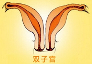 雙子宮是什么意思？雙子宮可以順產(chǎn)嗎？