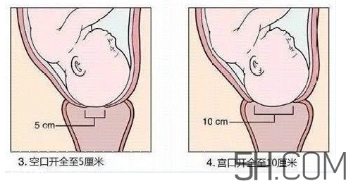 內(nèi)檢是什么感覺？內(nèi)檢有男醫(yī)生嗎？