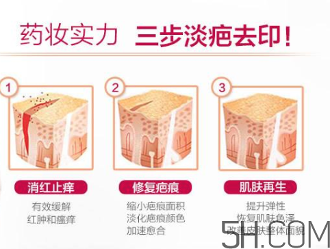 ISDIN怡思丁祛疤膏怎么用？ISDIN怡思丁祛疤膏使用說(shuō)明