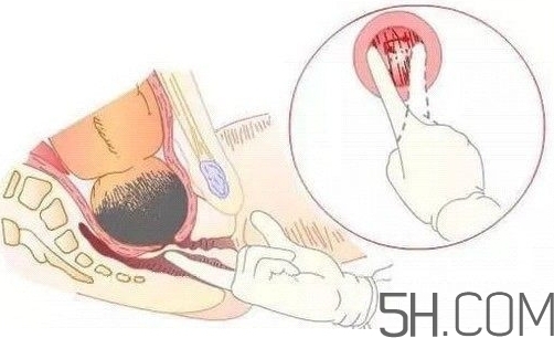 內(nèi)檢是什么感覺？內(nèi)檢有男醫(yī)生嗎？