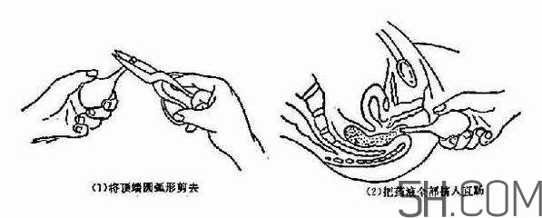 開(kāi)塞露怎么用？開(kāi)塞露用后多久會(huì)排便？
