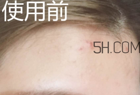 essence雙色遮瑕膏怎么用？essence雙色遮瑕膏使用心得