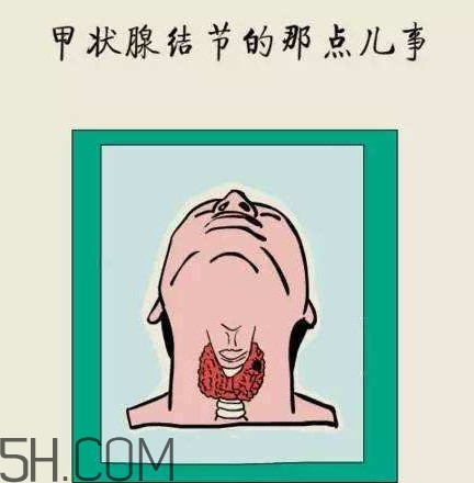 為什么會得甲狀腺結(jié)節(jié)？甲狀腺節(jié)結(jié)是什么？