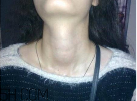 甲狀腺結(jié)節(jié)掛什么科？甲狀腺結(jié)節(jié)可以懷孕嗎