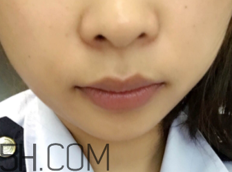 小蜜蜂細致修護唇膏很油嗎？夏天用合適嗎？