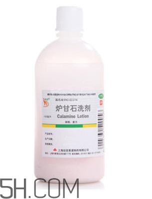 爐甘石洗劑是激素藥嗎？爐甘石洗劑是處方藥嗎？