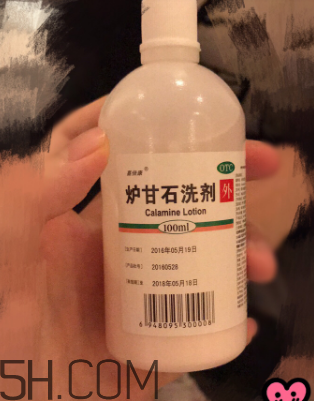 爐甘石洗劑是洗還是擦？爐甘石洗劑是什么顏色？