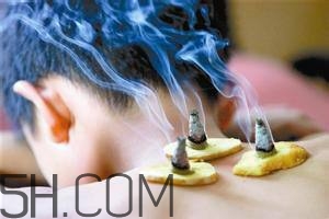 艾灸對慢性咽炎有用嗎？慢性咽炎可以通過艾灸來治療嗎？