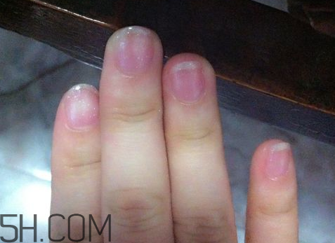 美甲后指甲受損怎么辦？指甲破損怎么修復(fù)？