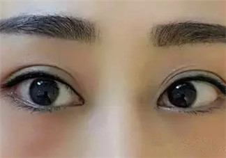 怎么紋美瞳線好看？紋美瞳線的危害