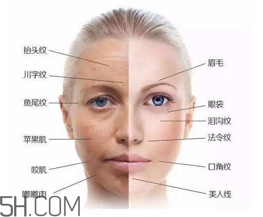 怎么預(yù)防皺紋的產(chǎn)生？導(dǎo)致皺紋的產(chǎn)生的原因有哪些？
