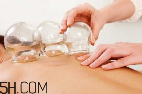 拔罐可以治療鼻炎嗎？鼻炎拔罐拔哪里？