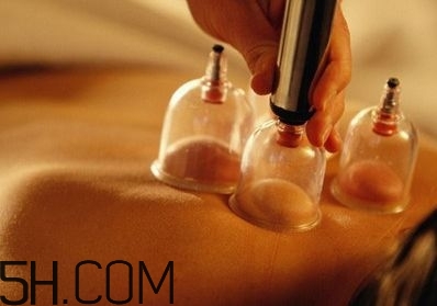 拔罐可以治療鼻炎嗎？鼻炎拔罐拔哪里？