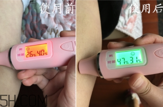 水楊酸可以去黑頭嗎？水楊酸可以去閉口嗎