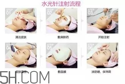 打水光針多久打一次？水光針的誤區(qū)