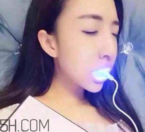 美牙儀可以兩個(gè)人用嗎？美牙儀用多久才有作用？