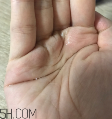 雪肌精卸妝油糊眼睛嗎？雪肌精卸妝油悶痘嗎？